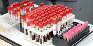 Кировская «ЦКДЛ», заработавшая на ПЦР-тестах миллиард рублей, перевозит свой бизнес из Самары в Пермь