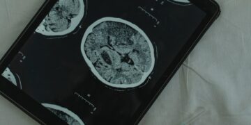 Ученые из США зафиксировали всплеск мозговой активности у людей перед смертью