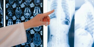 Главный онколог Самарской области: половина случаев рака легких выявляются в «запущенной» стадии