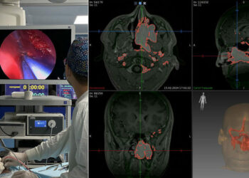 Самарские врачи спасли жизнь юноше с редкой болезнью, вернув ему нормальное дыхание