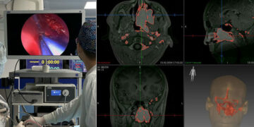 Самарские врачи спасли жизнь юноше с редкой болезнью, вернув ему нормальное дыхание
