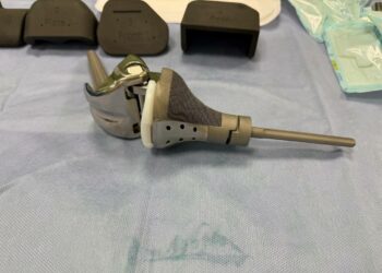 В Самаре выполнили редкую операцию: удаление опухоли коленного сустава с протезированием