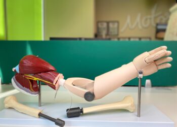 В СамГМУ испытали новые высокотехнологичные остеоинтегрируемые протезы 